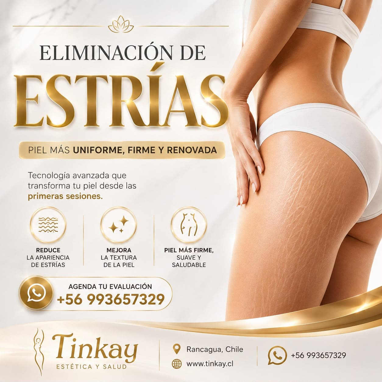 Eliminación de Estrías